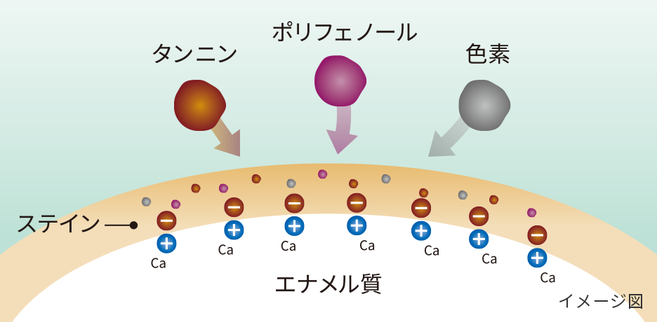 ステインについてイメージ図