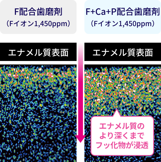 フッ化物浸透度の比較イメージ