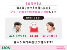 Systema Dentalpaste α_イメージ3