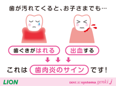 DENT.EX systema genki j_イメージ3