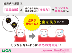 Systema ハグキプラス EX_イメージ3