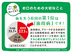 Systema ハグキプラス P-PRO_イメージ10