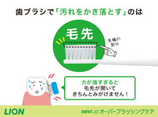 DENT.EX オーバーブラッシングケア_イメージ4