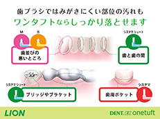 DENT.EX onetuft_イメージ3
