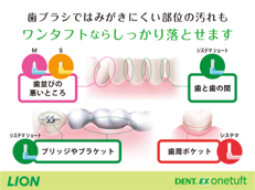 DENT.EX onetuft_イメージ3