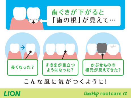 Check-Up rootcareα_イメージ2