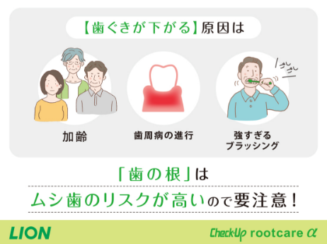 Check-Up rootcareα_イメージ3