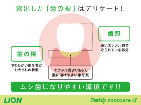 Check-Up rootcareα_イメージ4