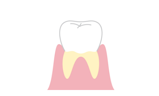 歯のイラスト_イメージ37