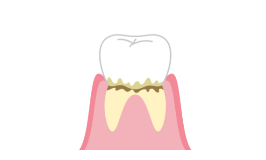 歯のイラスト_イメージ38