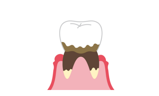 歯のイラスト_イメージ40