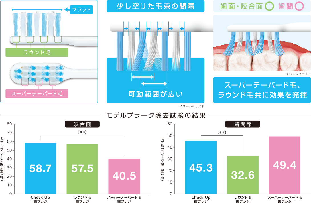 フラットダブル植毛の構造説明