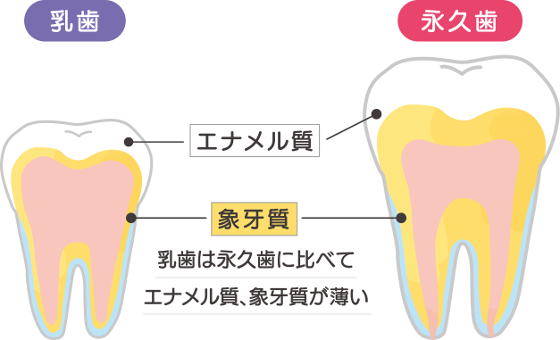 乳歯は永久歯に比べてエナメル質、象牙質が薄い