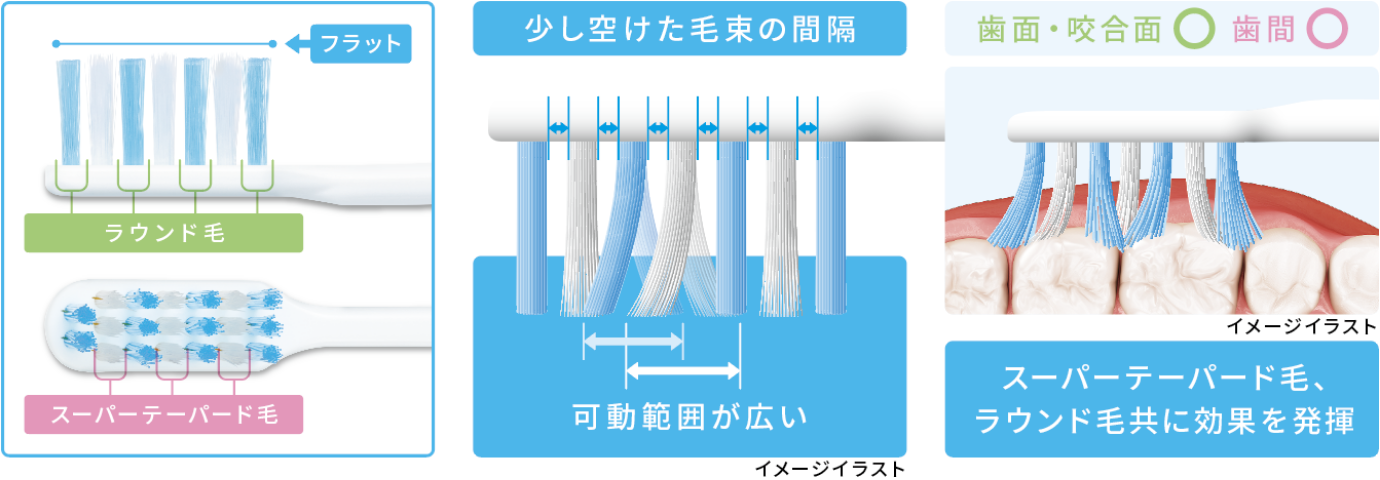 ラウンド毛でフラット。スーパーテーパード毛。少し空けた毛束の間隔だから可動範囲が広い。スーパーテーパード毛、ラウンド毛共に効果を発揮。歯面・咬合面マル。歯間マル。