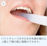 5. バイトチューブはそのまま先端を噛むと上顎と下顎の間に隙間ができます。