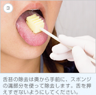 3. 舌苔の除去は奥から手前に、スポンジの溝部分を使って除去します。舌を押えすぎないようにしてください。