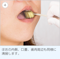 4. ほおの内側、口蓋、歯肉周辺も同様に清掃します。